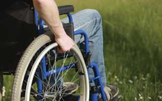 При ревматоидном артрите дают инвалидность