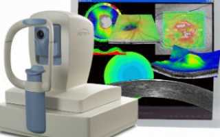 Оптическая когерентная томография сетчатки