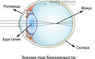 Капли для улучшения зрения при близорукости