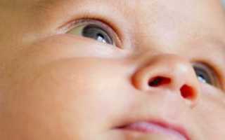 У новорожденных желтые белки глаз