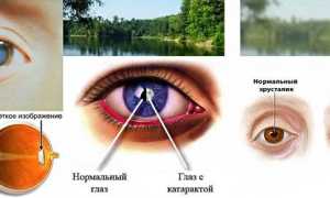 Глазные капли для улучшения зрения