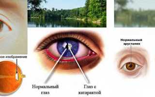 Глазные капли для улучшения зрения