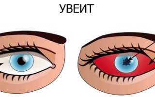 Гормональные капли для глаз