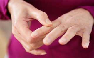 Болят суставы пальцев рук причины и лечение
