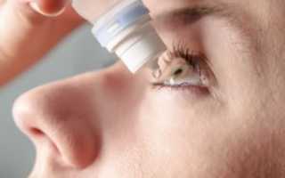 Лечение кератита глаза