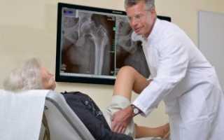 Какой врач лечит тазобедренный сустав