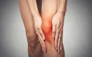 Асептический некроз коленного сустава