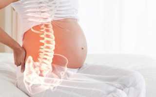 Артроз и беременность