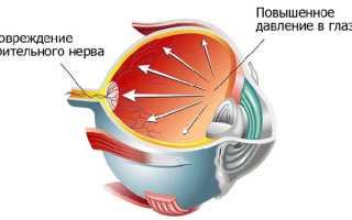 Упражнения для глаз при глаукоме