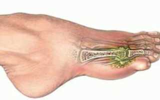 Перелом пальца на ноге