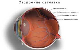 Пересадка сетчатки глаза