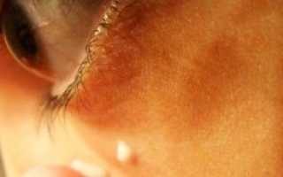Крем филлер для кожи вокруг глаз
