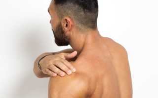 Вывих плечевого сустава
