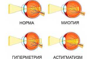 Что лучше линзы или очки