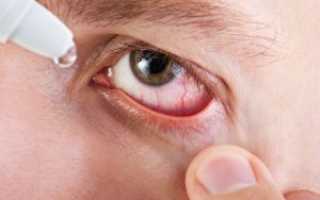 Капли для глаз антибактериальные и противовоспалительные