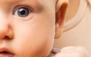 Цвет глаз у новорожденных когда формируется