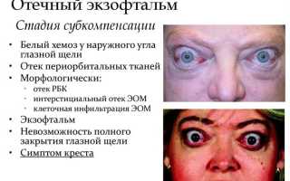 Болезнь выпученные глаза