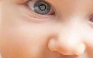 Симптомы катаракты у взрослых