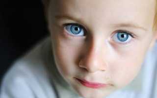 Глаукома у детей
