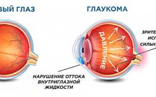 Слезные каналы глаза