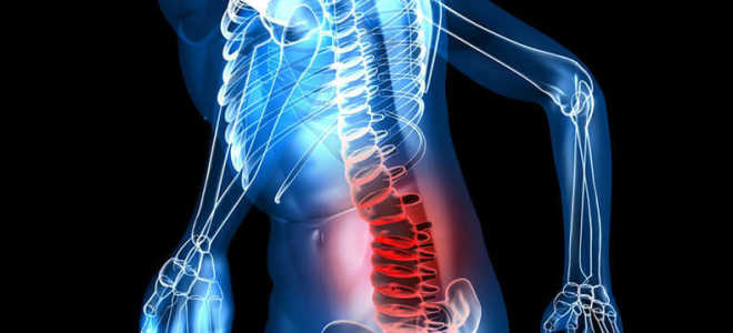 Упражнения при остеохондрозе пояснично крестцового отдела позвоночника