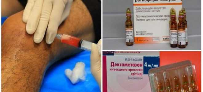 Уколы при подагре