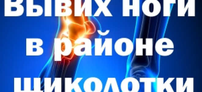 Вывих ноги в районе щиколотки